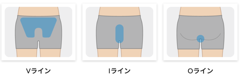 メンズジェニー　VIO　ヒップ　画像